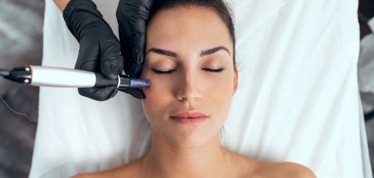 Rf Microneedling How It Works And Why It S A Game Changer