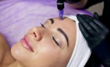 could-rf-microneedling-be-right-for-you